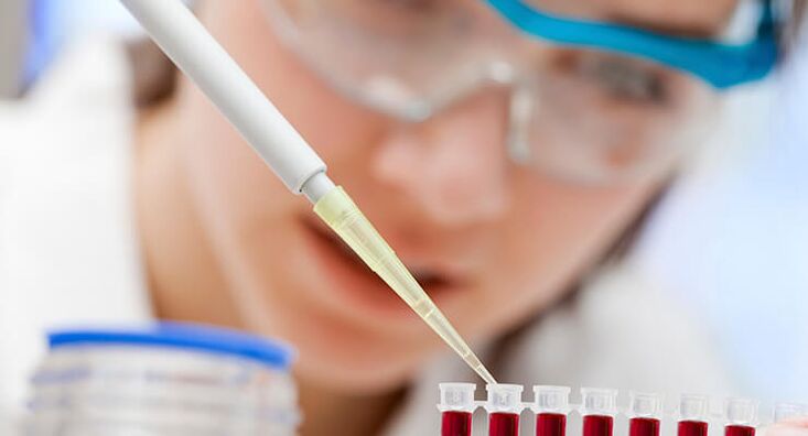 Tests sanguins pour l'arthrose de la hanche