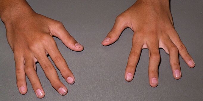 Les articulations des doigts font mal