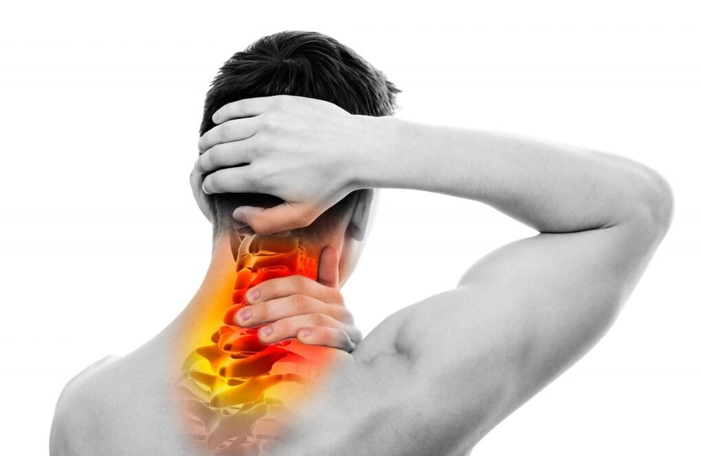 Symptômes de l'ostéochondrose cervicale